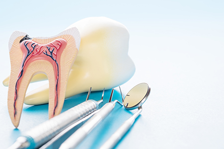 The image shows a dental model with a tooth missing, accompanied by surgical instruments and a medical textbook on a blue background.
