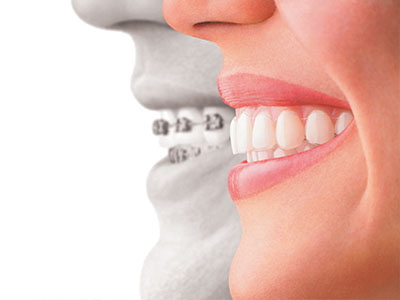 The image features a split-screen graphic with one half showing a smiling woman and the other depicting a person s teeth, likely representing dental health or oral care.